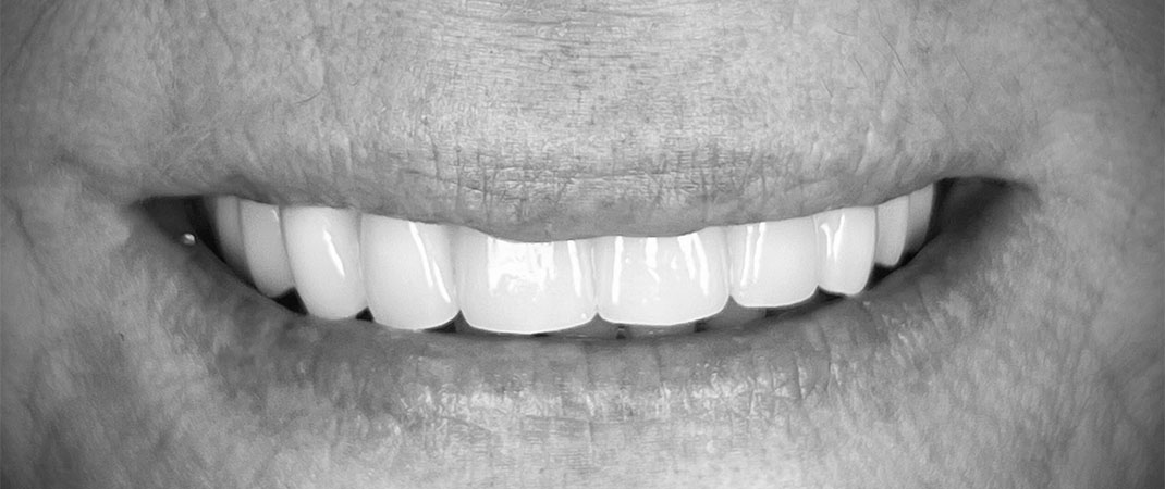 Clear aesthetic concept